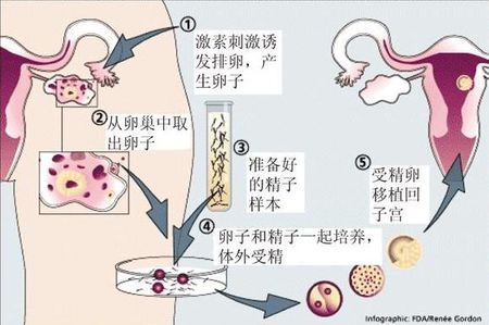 林教授
